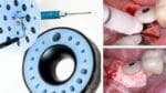Cervico Protocol