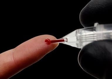 Blood test for vitamin d deficiency