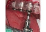 Guided Digital Plan and 3d Surgical Guide