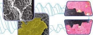 Dental Implant, Conical Connection, Primary Stability, Bioner, TopDM