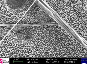 Chondro-Matrix-SEM-2000