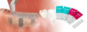 Ora-Aid self adhering Intra Oral Dressing